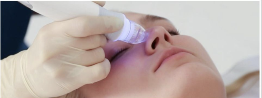 lw-dermabrasion