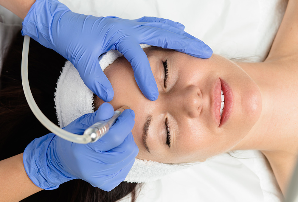 microdermabrasion-treatment